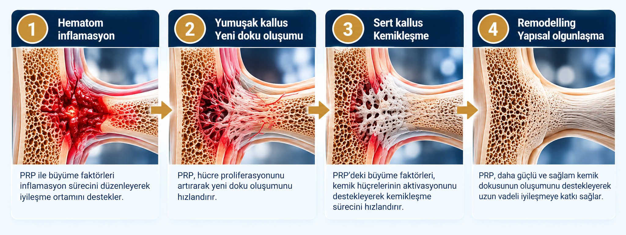 Kemik iyileşmesinin biyolojik evreleri